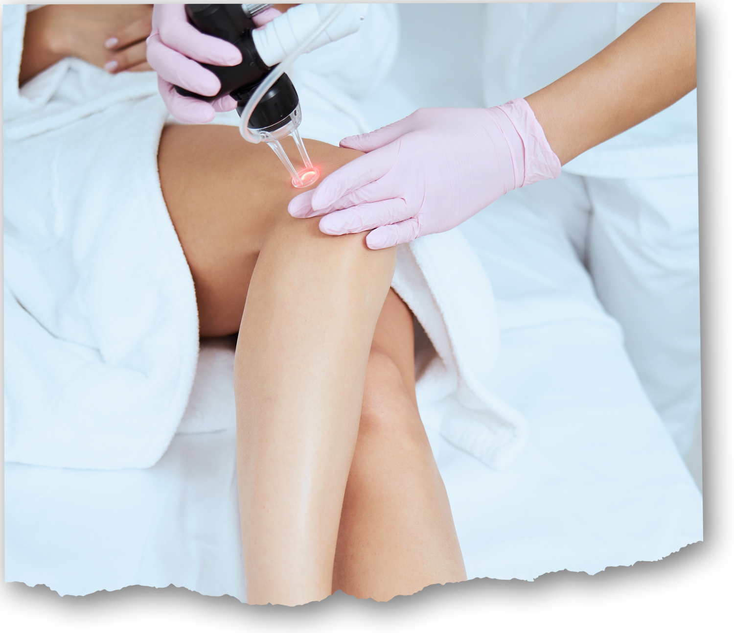 Piscataway, NJ, Laser Vein Removal